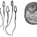 lydia-estes-pinkham-treatise-on-the-diseases-of-women-f001.jpg