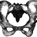 lydia-estes-pinkham-treatise-on-the-diseases-of-women-f002.jpg