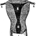lydia-estes-pinkham-treatise-on-the-diseases-of-women-f004.jpg