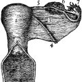 lydia-estes-pinkham-treatise-on-the-diseases-of-women-f005.jpg