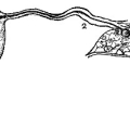 lydia-estes-pinkham-treatise-on-the-diseases-of-women-f008.jpg