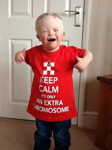 Keep Calm, It's Only An Extra Chromosome