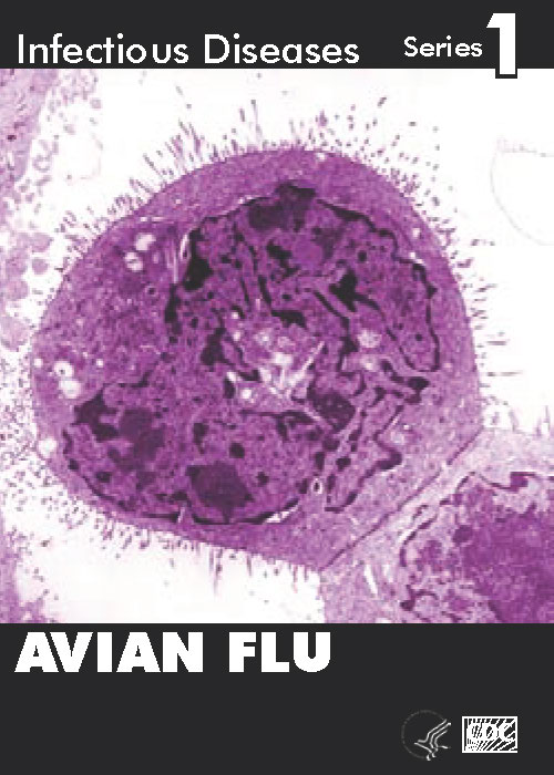 Infectious Disease Trading Cards - Series 1 - Avian Flu - Front