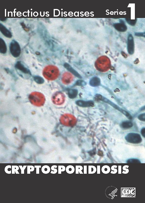 Infectious Disease Trading Cards - Series 1 - Cryptosporidiosis - Front