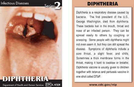 Infectious Disease Trading Cards - Series 2 - Diptheria