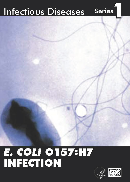 Infectious Disease Trading Cards - Series 1 - E. Coli O157:H7 Infection - Front