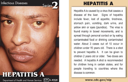 Infectious Disease Trading Cards - Series 2 - Hepatitis A