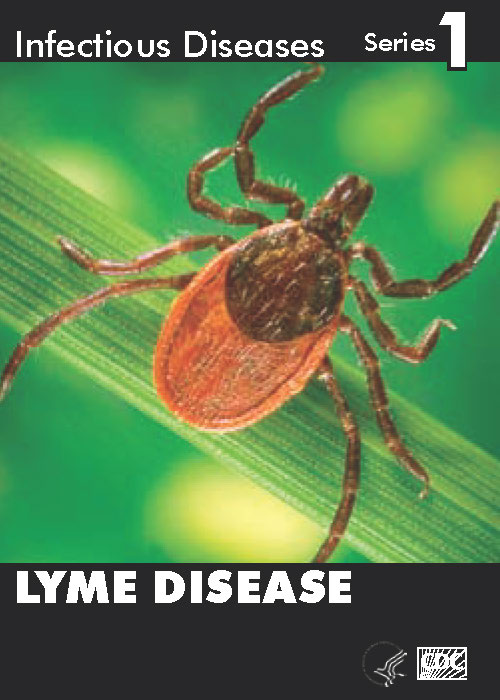 Infectious Disease Trading Cards - Series 1 - Lyme Disease - Front