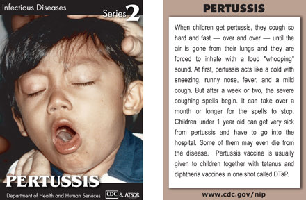 Infectious Disease Trading Cards - Series 2 - Pertussis