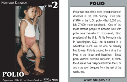 Infectious Disease Trading Cards - Series 2 - Polio