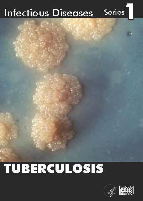 Infectious Disease Trading Cards - Series 1 - Tuberculosis - Front