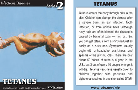 Infectious Disease Trading Cards - Series 2 - Tetanus